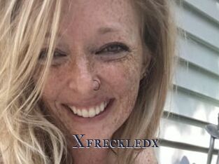 Xfreckledx